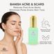 Сыворотка-Пилинг с кислотами Aha+Bha, Global Fashion, Aha+Bha Serum Peeling Solution Face Serum, 50ml 25085 фото 2